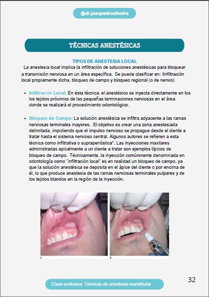 Técnicas