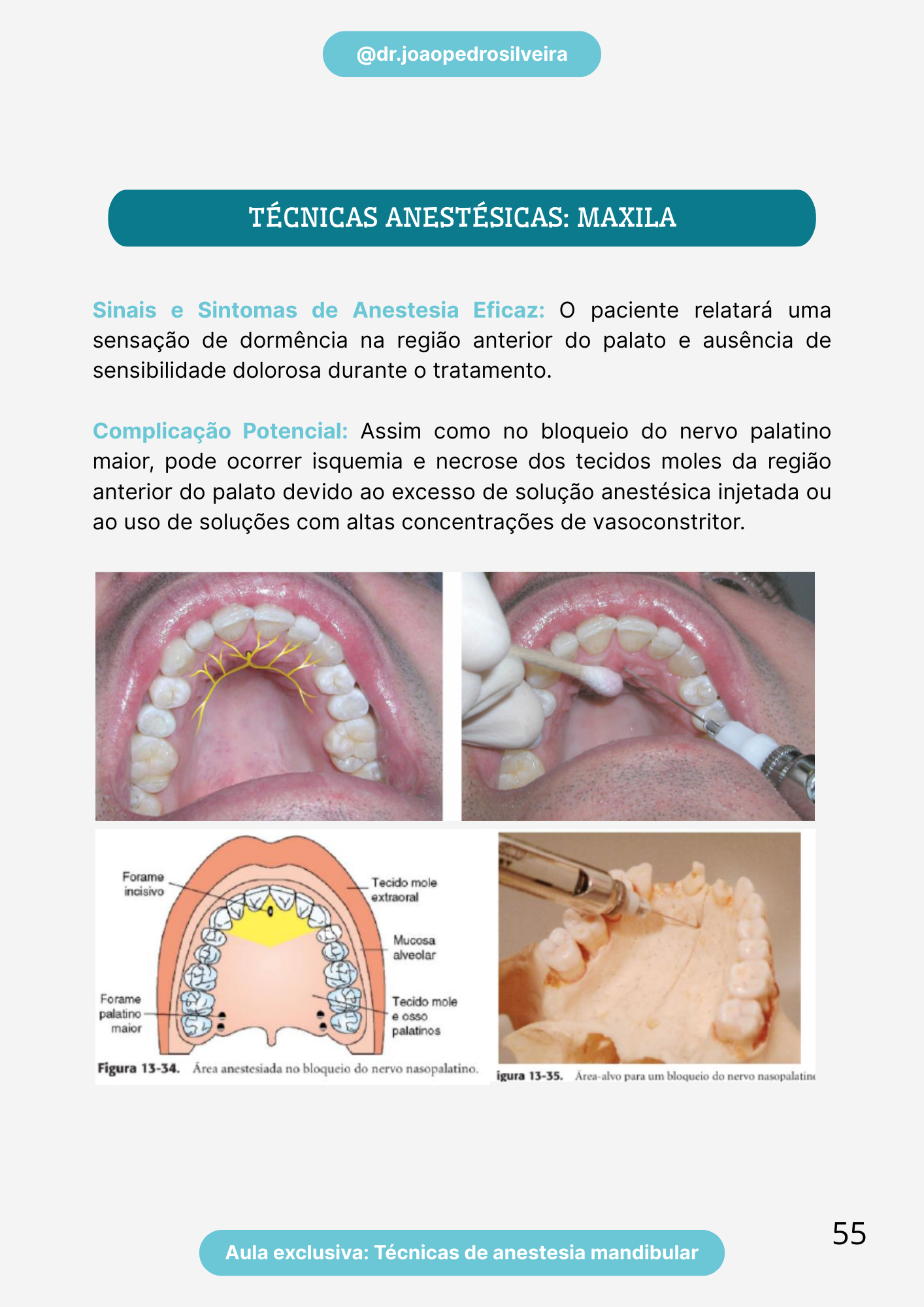 Anestesiologia pág. 55