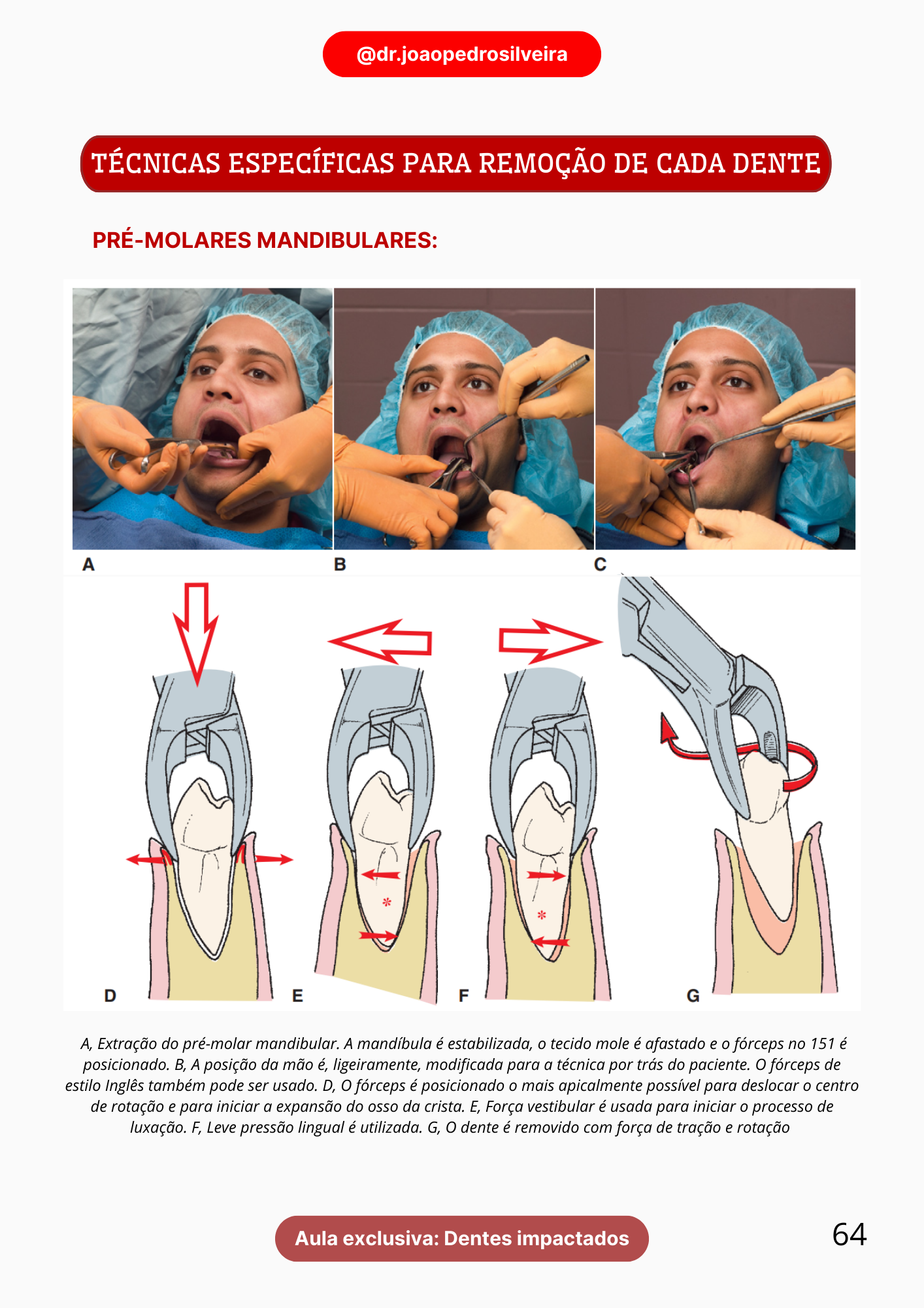 Cirurgia pág. 64