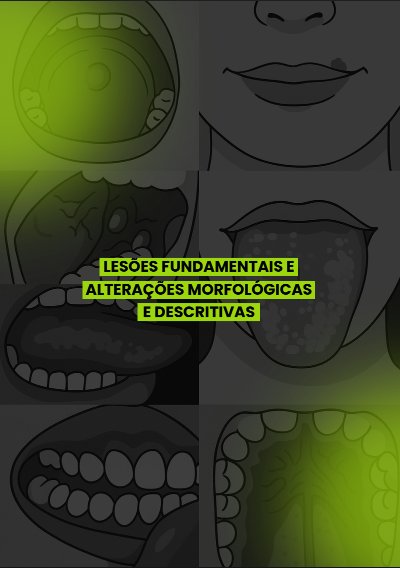 Lesões Fundamentais na Patologia Bucal